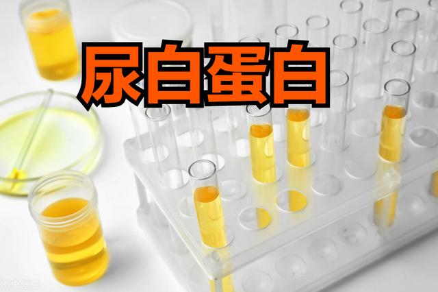 高血压伤肾！哪些检查可以看出来？心脏医生说：留心4个化验指标