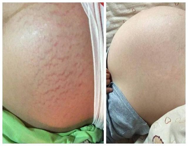 凉年|怀孕5个月，晚上困也睡不着怎么办？关注这五点，孕妈胎儿少遭罪