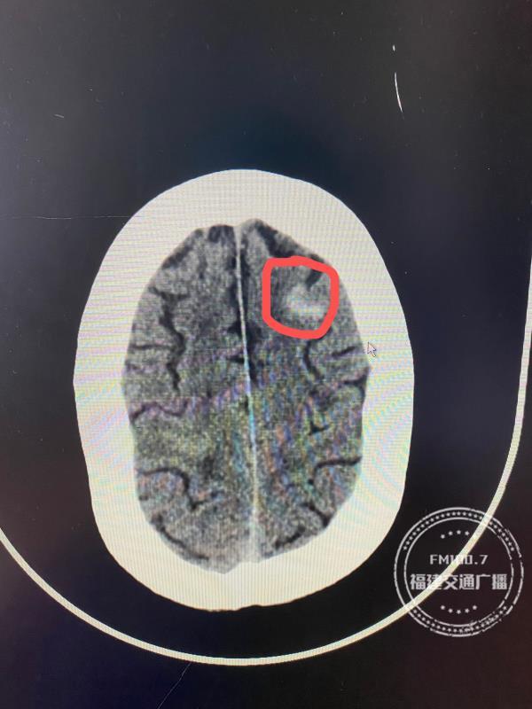 天气降温温泉受欢迎，福州却有老人泡完脑出血了