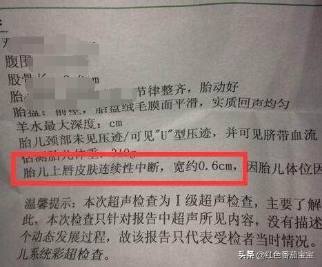你的育儿经■怀孕4个月查出兔唇,一家人痛哭流涕,大夫指责小两口没责任