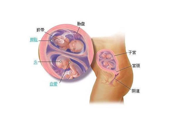 你的育儿经▲试管婴儿可以怀双胞胎龙凤胎？怀双胎健康风险大