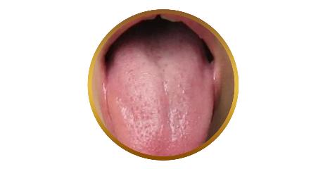 你的育儿经|看舌头，看健康！宝宝这4种常见舌象，都反映什么问题？