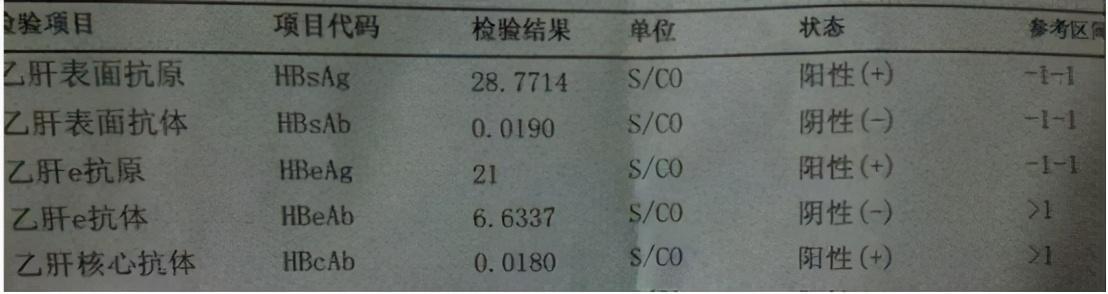 拿到乙肝检查报告一头雾水，如何快速看懂？