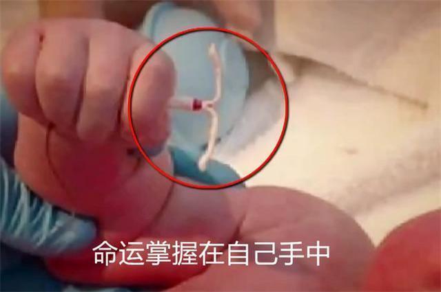 [超级宝妈]“暴躁宝宝”走红，一出生就瞪着医生，网友配的台词亮了