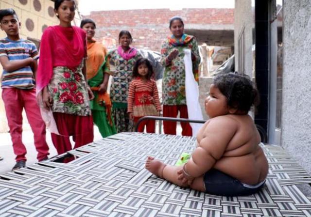 [超级宝妈]1岁体重就高达45斤的“米其林宝宝”，如今啥样了？不出人们所料