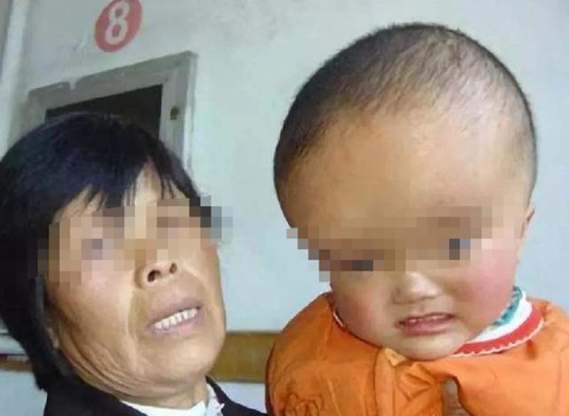 超级宝妈▲再现“大头娃娃”！湖南“假奶粉”坑骗家长，幼儿颅骨突出起湿疹