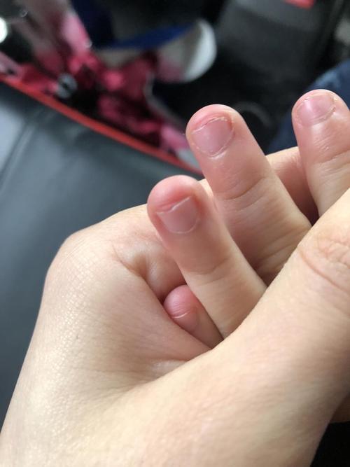 【你的育儿经】喜欢“咬指甲”的孩子，长大后逃不掉这2种结局，父母要尽早纠正