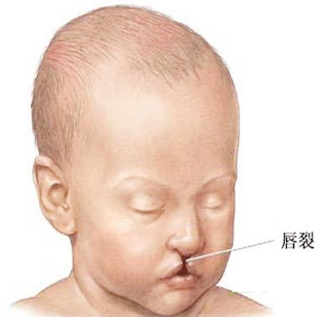 「超级宝妈」孕妈怀孕35周，却被医生告知胎儿没了胎心，这个情况一定要小心