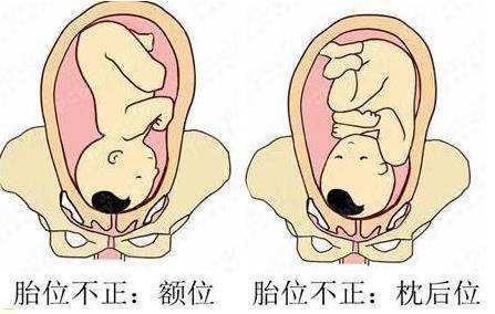 【你的育儿经】准妈妈怀孕晚期，老是右边胎动？3个原因要清楚，最后一个很暖心