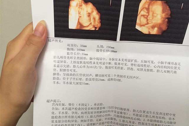 你的育儿经@早被“叫停”的三个孕检项目，若医生套路你去做，大都别有用心