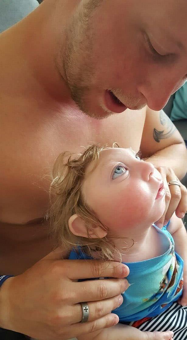 「你的育儿经」男孩出生时头骨缺陷被认为不能存活，父母不放弃养到5岁还是离世