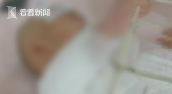 光明网▲1岁女童掉入70℃热水锅烧伤严重 发现时已休克