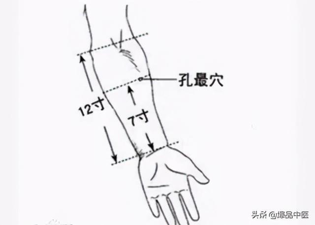 「最全配图」急性腰扭伤有几种“一针疗法”