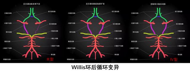 脑内的Willis环，你知道吗？