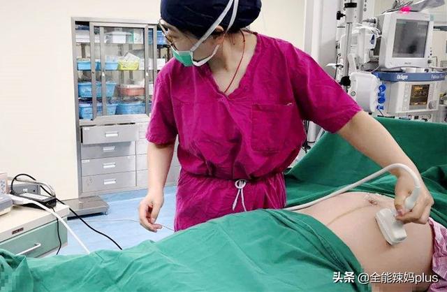 国民帅比|“假如能重来,我要选顺产”,95后宝妈的理由,让人无力反驳