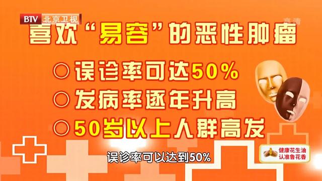 骨髓瘤|这种恶性肿瘤会伪装，误诊率50%！两管血、一管尿，早早检测