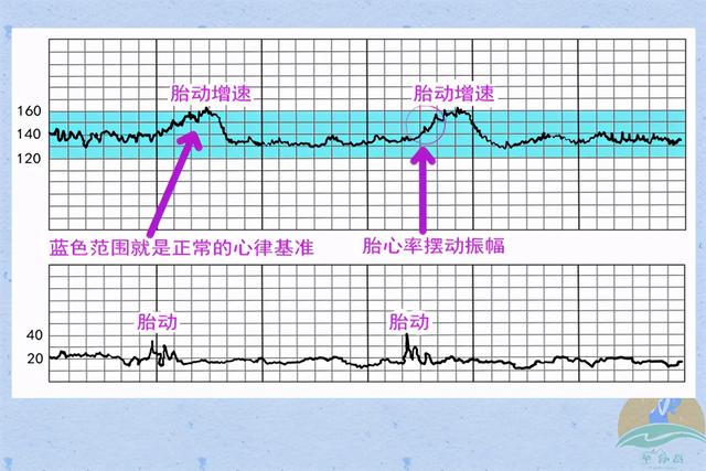 家庭版胎心仪真的好用吗？双十一省钱攻略：这两个免费方法最实用