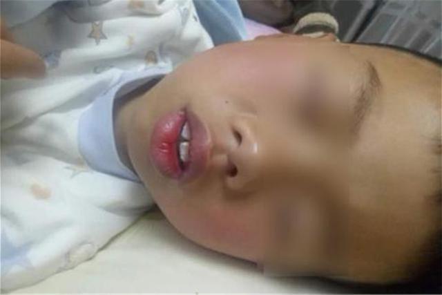 超级宝妈■挺可爱的孩子结果越长越丑，甚至像“猩猩”？检查之后宝妈后悔了