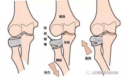 宝宝|和宝宝玩耍时，宝宝突然大哭有可能是脱臼了，该怎么办呢？