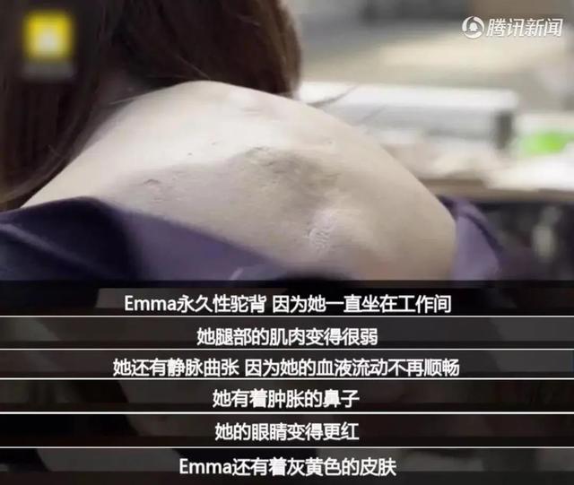 你的育儿经▲“久坐族20年后的样子”吓坏很多人！赶紧提醒孩子，站起来动动吧
