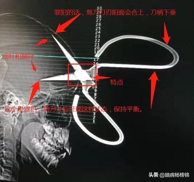 你的育儿经▲熊孩嬉闹 剪刀入脑 上篇飞刀 这个更孬