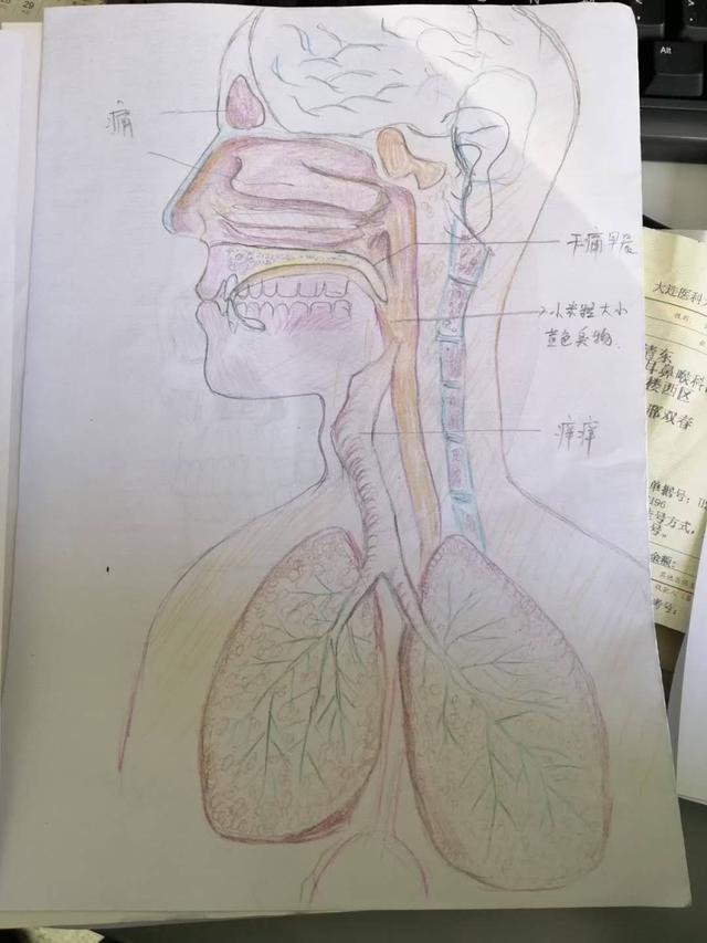 大连一患者带着手绘去就诊，医生感叹：症状描述简单准确