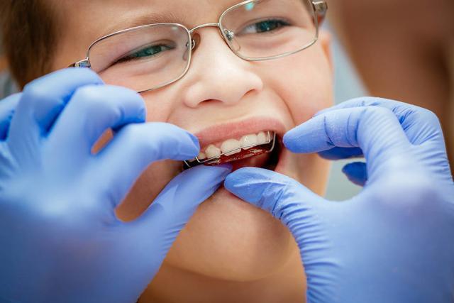 家长牢记:儿童做牙齿矫正三个最佳时间,矫治越早干预