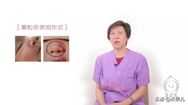 你的育儿经|宝宝嘴边长红疹,原来是这样引起的