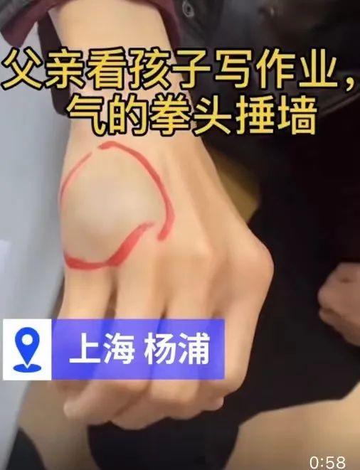 作业|爸爸辅导作业“上火”，结果……