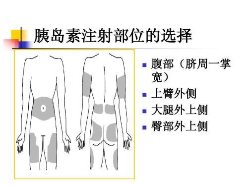 如何减少血糖波动?4步正确打胰岛素