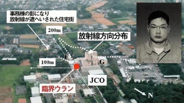 大内|史上“最痛苦”的离世，被医生强行续命83天，每天活的身不由己