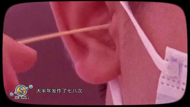 中耳炎|女子洗头时耳朵进水，一年多后险丧命，这种坏习惯很多人都有