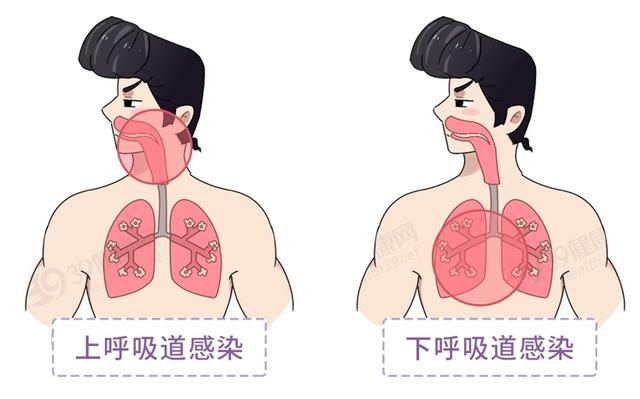 感染|春季咽喉不适千万别硬撑，严重可诱发肺炎
