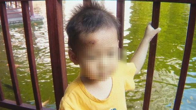 温暖的襁褓|3岁韶关男童在幼儿园受伤，被缝四针！这已经是第二次......