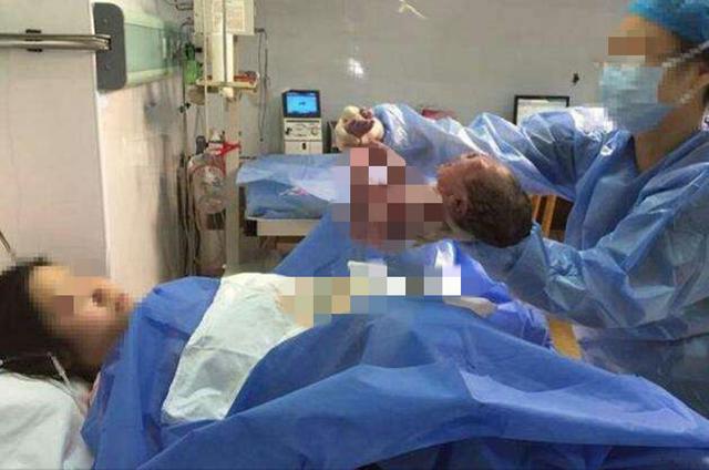 超级宝妈■剖腹产产妇7天后刀口“裂开”,医生怒斥:不配做丈夫