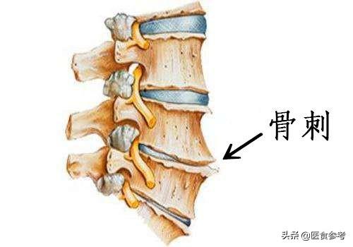 结节、息肉、囊肿、增生...哪个最可能癌变？这么多年疑惑终于解开了！