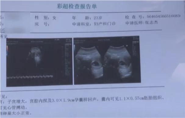 23岁姑娘全麻做整形，术后2天恶心反胃，一查呆住：怀孕了