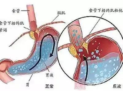 戴口罩有股臭味，究竟是口罩臭还是口臭？