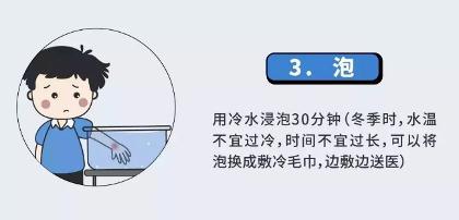 烫伤|因为洗澡，2岁娃被送进ICU！医生：记牢五个字能救命