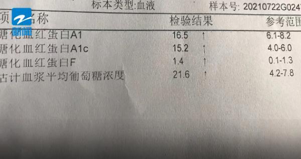 可乐|浙江一15岁男孩右眼接近失明，只因为常喝……很多人都喜欢