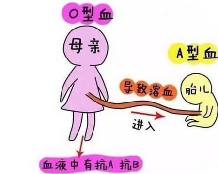 超级宝妈|哪些孕妇需要警惕溶血症及怎样预防溶血症?医生讲给你听
