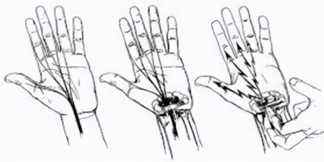 手麻、手疼、手无力，这下终于知道为什么了