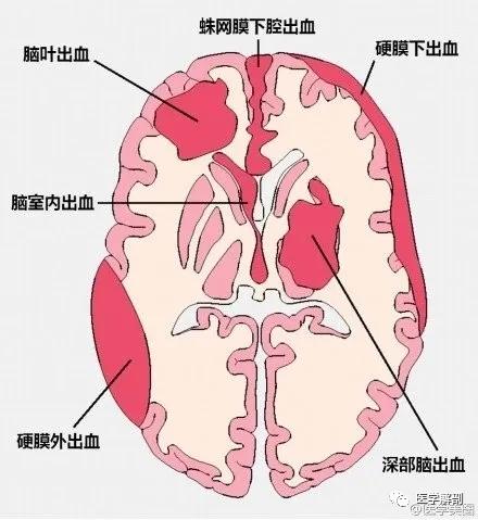 WoW，最全神经系统解剖图来了