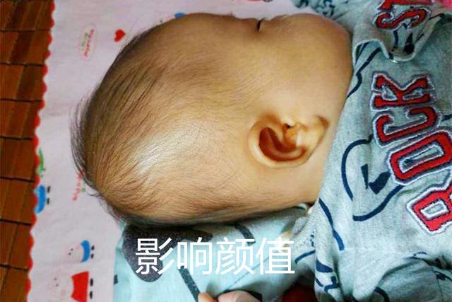 【天使宝贝】为何老一辈坚持给宝宝“睡扁头”，很影响宝宝的颜值，不信你看