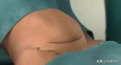 『超级宝妈』剖腹产很容易的，产妇说疼都是矫情，这句话遭受产妇怒斥