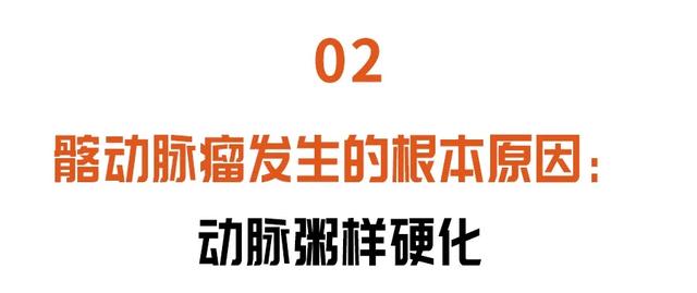 血管|下腹有硬块别忽视，小心引发大出血，死亡率50%！三招早发现