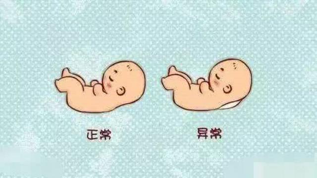 超级宝妈|NT筛查异常怎么办，新手孕妈要知晓
