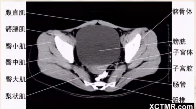 影像解剖：胸、腹部、盆腔CT解剖