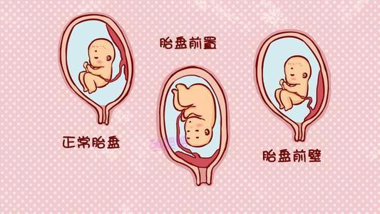 【你的育儿经】孕期胎盘前置不要害怕,孕妈做好这4点,胎盘慢慢长上去