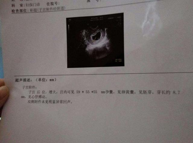 你的育儿经|8周不见胎心芽，宝宝是不是不在啦？